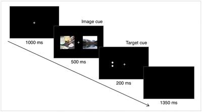 Neural Correlates of Drug-Related Attentional Bias in Heroin Dependence